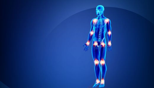 Chronic Joint and Musculoskeletal Pain